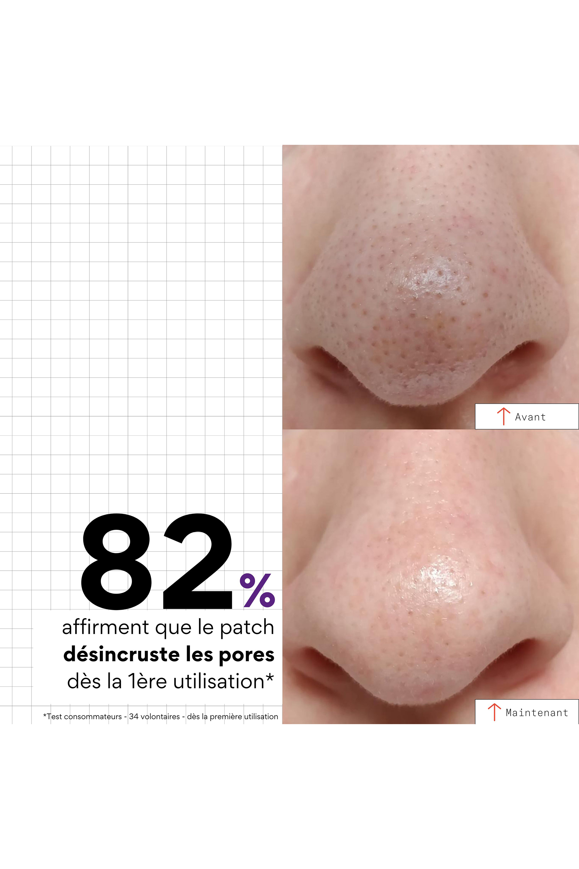 Patchs nez purifiants Peel out