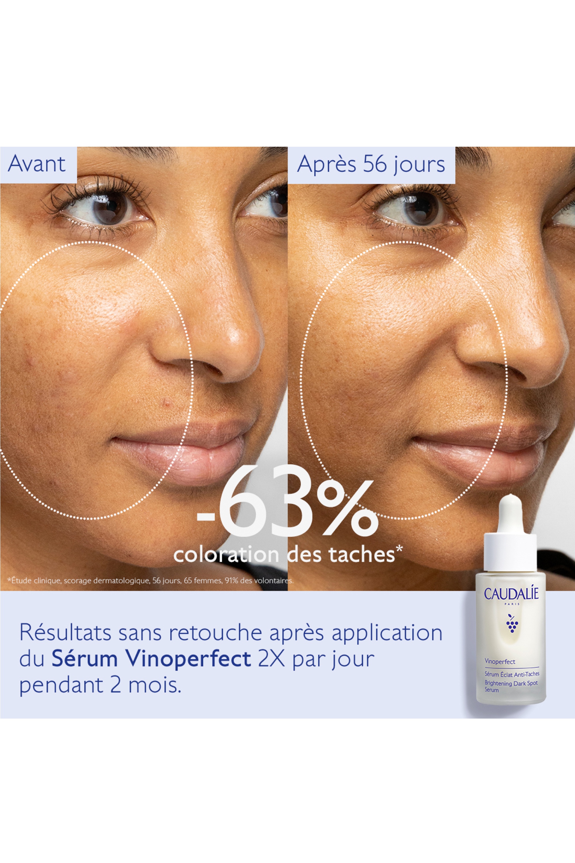 30ml